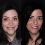 cosmetic-dental-treatment-park-ave-dental-aesthetics