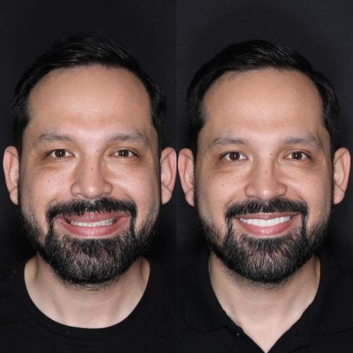 smile transform at park ave dental