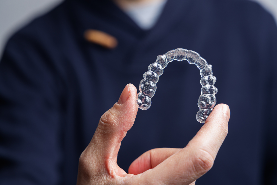 Invisalign example