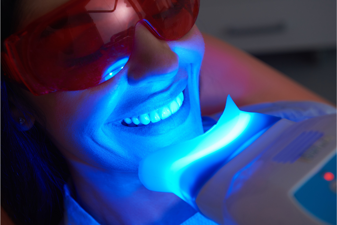 teeth whitening technology