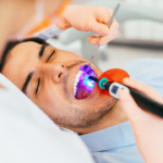 dental bonding