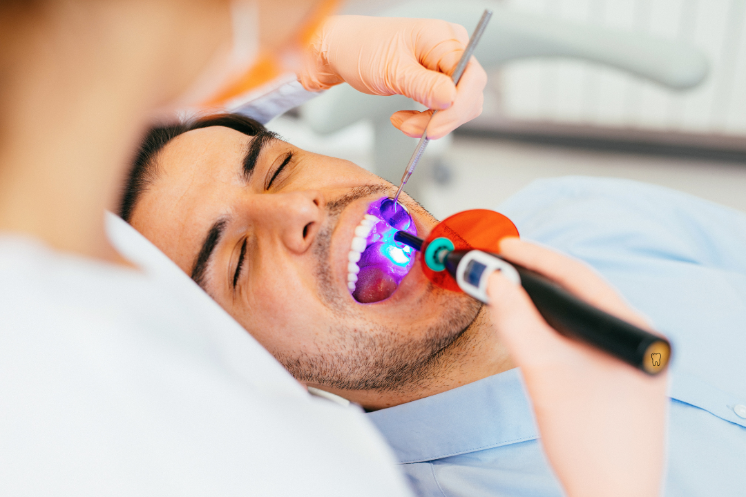dental bonding